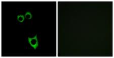 VPAC2 / VIPR2 Antibody - Immunofluorescence analysis of MCF7 cells, using VIPR2 Antibody. The picture on the right is blocked with the synthesized peptide.