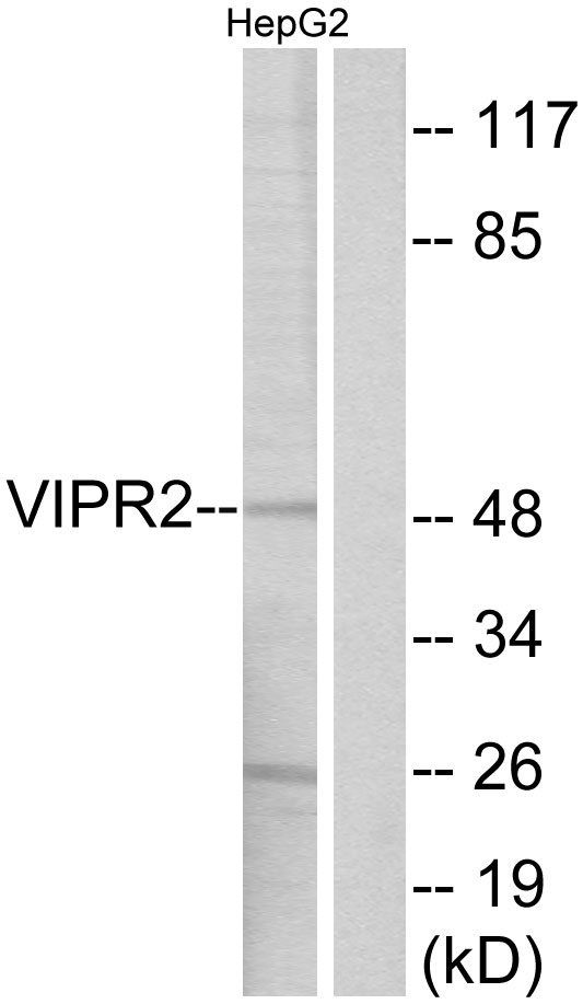 VPAC2 / VIPR2 Antibody - Western blot analysis of lysates from HepG2 cells, using VIPR2 Antibody. The lane on the right is blocked with the synthesized peptide.