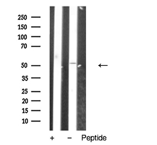 VPAC2 / VIPR2 Antibody - Western blot analysis of extracts of HepG2 cells using VIPR2 antibody.