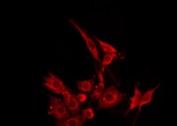 VPAC2 / VIPR2 Antibody - Staining HepG2 cells by IF/ICC. The samples were fixed with PFA and permeabilized in 0.1% Triton X-100, then blocked in 10% serum for 45 min at 25°C. The primary antibody was diluted at 1:200 and incubated with the sample for 1 hour at 37°C. An Alexa Fluor 594 conjugated goat anti-rabbit IgG (H+L) Ab, diluted at 1/600, was used as the secondary antibody.