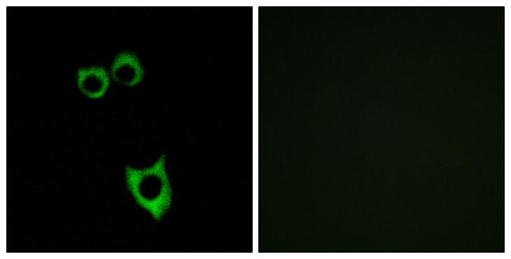 VPAC2 / VIPR2 Antibody - Peptide - + Immunofluorescence analysis of MCF-7 cells, using VIPR2 antibody.
