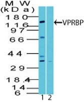 VPRBP Antibody - Western Blot: VprBP Antibody - analysis of VPRBP using VPRBP antibody. Human brain tissue lysate in the 1) absence and 2) presence of immunizing peptide probed with 2 ug/ml of VPRBP antibody. I goat anti-rabbit Ig HRP secondary antibody and PicoTect ECL substrate solution were used for this test.