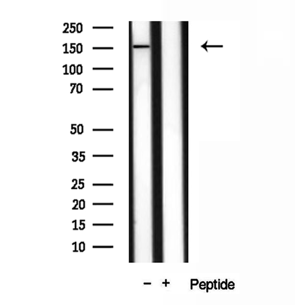VPRBP Antibody - Western blot analysis of extracts of HEK293 cells using VPRBP antibody.