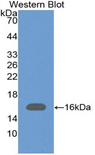 VPREB1 / CD179A Antibody - Western blot of recombinant VPREB1 / CD179A.