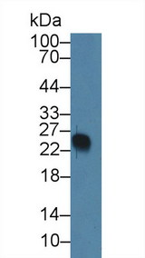 VPREB1 / CD179A Antibody - Western Blot; Sample: Human Serum; Primary Ab: 5µg/ml Rabbit Anti-Human VPREB1 Antibody Second Ab: 0.2µg/mL HRP-Linked Caprine Anti-Rabbit IgG Polyclonal Antibody