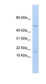 VPREB1 / CD179A Antibody - VPREB1 antibody Western blot of HepG2 cell lysate. This image was taken for the unconjugated form of this product. Other forms have not been tested.