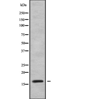 VPREB1 / CD179A Antibody - Western blot analysis of VPREB1 using MCF-7 whole cells lysates
