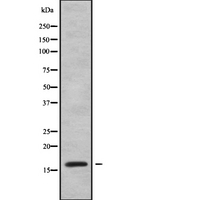 VPREB1 / CD179A Antibody - Western blot analysis of VPREB1 using MCF-7 whole cells lysates