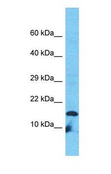 VPREB3 Antibody - Western blot of VPREB3 Antibody with HT1080 Whole Cell lysate.  This image was taken for the unconjugated form of this product. Other forms have not been tested.