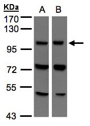 VPS11 Antibody - Sample (30 ug of whole cell lysate). A:293T, B: Hep G2. 7.5% SDS PAGE. VPS11 antibody diluted at 1:500