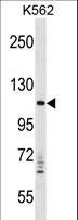 VPS11 Antibody - VPS11 Antibody western blot of K562 cell line lysates (35 ug/lane). The VPS11 antibody detected the VPS11 protein (arrow).