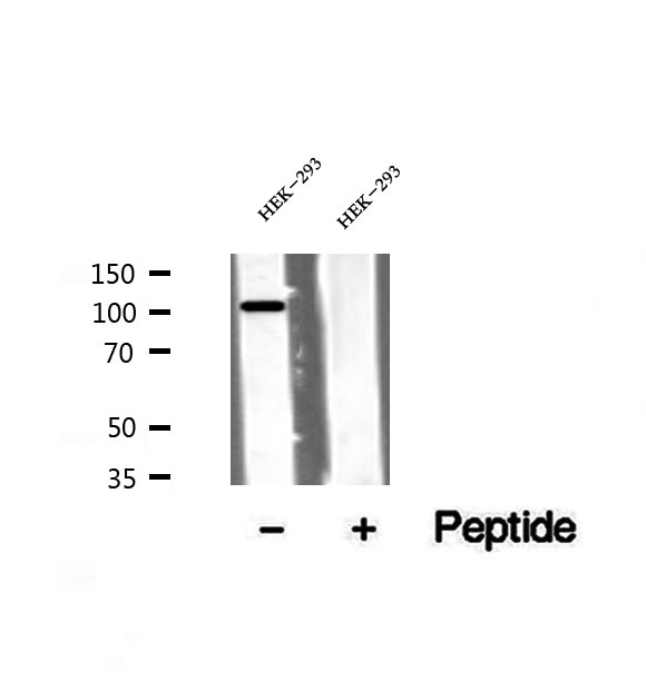 VPS11 Antibody - Western blot analysis of extracts of HEK293 cells using VPS11 antibody.