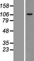 VPS11 Protein - Western validation with an anti-DDK antibody * L: Control HEK293 lysate R: Over-expression lysate