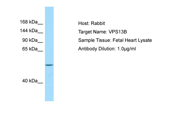 VPS13B Antibody -  This image was taken for the unconjugated form of this product. Other forms have not been tested.