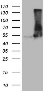 VPS13B Antibody - HEK293T cells were transfected with the pCMV6-ENTRY control. (Left lane) or pCMV6-ENTRY VPS13B. (Right lane) cDNA for 48 hrs and lysed. Equivalent amounts of cell lysates. (5 ug per lane) were separated by SDS-PAGE and immunoblotted with anti-VPS13B. (1:2000)