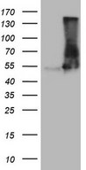 VPS13B Antibody - HEK293T cells were transfected with the pCMV6-ENTRY control. (Left lane) or pCMV6-ENTRY VPS13B. (Right lane) cDNA for 48 hrs and lysed. Equivalent amounts of cell lysates. (5 ug per lane) were separated by SDS-PAGE and immunoblotted with anti-VPS13B. (1:2000)