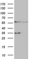 VPS13B Antibody - HEK293T cells were transfected with the pCMV6-ENTRY control. (Left lane) or pCMV6-ENTRY VPS13B. (Right lane) cDNA for 48 hrs and lysed. Equivalent amounts of cell lysates. (5 ug per lane) were separated by SDS-PAGE and immunoblotted with anti-VPS13B. (1:500)