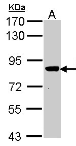 VPS16 Antibody - Sample (30 ug of whole cell lysate). A: Molt-4 . 7.5% SDS PAGE. VPS16 antibody diluted at 1:1000.