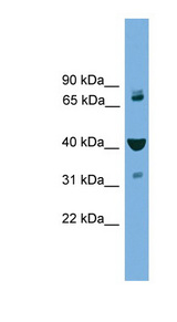 VPS16 Antibody - VPS16 antibody Western blot of MCF7 cell lysate. This image was taken for the unconjugated form of this product. Other forms have not been tested.