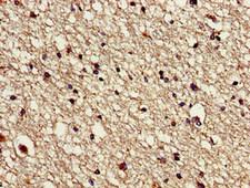 VPS16 Antibody - Immunohistochemistry image of paraffin-embedded human brain tissue at a dilution of 1:100