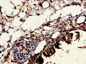 VPS16 Antibody - Immunohistochemistry image of paraffin-embedded human lung tissue at a dilution of 1:100