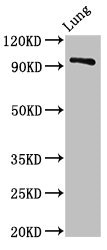 VPS16 Antibody - Positive Western Blot detected in Rat lung tissue. All lanes: VPS16 antibody at 3 µg/ml Secondary Goat polyclonal to rabbit IgG at 1/50000 dilution. Predicted band size: 95, 79 KDa. Observed band size: 95 KDa