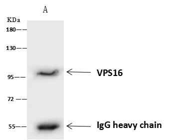 VPS16 Antibody - VPS16 was immunoprecipitated using: Lane A: 0.5 mg Jurkat Whole Cell Lysate. 4 uL anti-VPS16 rabbit polyclonal antibody and 60 ug of Immunomagnetic beads Protein A/G. Primary antibody: Anti-VPS16 rabbit polyclonal antibody, at 1:100 dilution. Secondary antibody: Goat Anti-Rabbit IgG (H+L)/HRP at 1/10000 dilution. Developed using the ECL technique. Performed under reducing conditions. Predicted band size: 95 kDa. Observed band size: 95 kDa.
