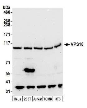 VPS18 Antibody - Detection of human and mouse VPS18 by western blot. Samples: Whole cell lysate (50 µg) from HeLa, HEK293T, Jurkat, mouse TCMK-1, and mouse NIH 3T3 cells prepared using NETN lysis buffer. Antibody: Affinity purified rabbit anti-VPS18 antibody used for WB at 0.1 µg/ml. Detection: Chemiluminescence with an exposure time of 30 seconds.
