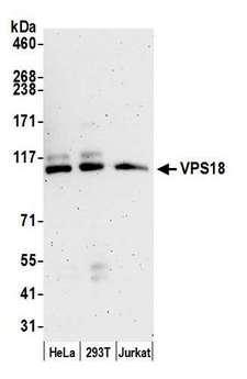 VPS18 Antibody - Detection of human VPS18 by western blot. Samples: Whole cell lysate (15 µg) from HeLa, HEK293T, and Jurkat cells prepared using NETN lysis buffer. Antibody: Affinity purified rabbit anti-VPS18 antibody used for WB at 0.1 µg/ml. Detection: Chemiluminescence with an exposure time of 3 minutes.