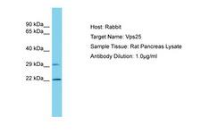 VPS25 Antibody -  This image was taken for the unconjugated form of this product. Other forms have not been tested.