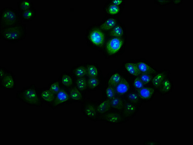 VPS25 Antibody - Immunofluorescence staining of Hela cells with VPS25 Antibody at 1:100, counter-stained with DAPI. The cells were fixed in 4% formaldehyde, permeabilized using 0.2% Triton X-100 and blocked in 10% normal Goat Serum. The cells were then incubated with the antibody overnight at 4°C. The secondary antibody was Alexa Fluor 488-congugated AffiniPure Goat Anti-Rabbit IgG(H+L).