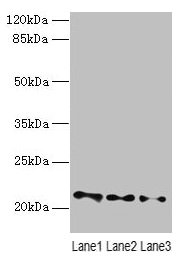 VPS25 Antibody - Western blot All lanes: VPS25 antibody at 3µg/ml Lane 1: Mouse kidney tissue Lane 2: HL60 whole cell lysate Lane 3: THP-1 whole cell lysate Secondary Goat polyclonal to rabbit IgG at 1/10000 dilution Predicted band size: 21 kDa Observed band size: 21 kDa