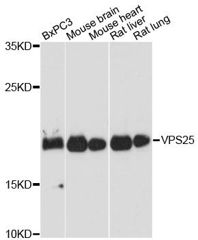 VPS25 Antibody - Western blot analysis of extracts of various cell lines, using VPS25 antibody at 1:3000 dilution. The secondary antibody used was an HRP Goat Anti-Rabbit IgG (H+L) at 1:10000 dilution. Lysates were loaded 25ug per lane and 3% nonfat dry milk in TBST was used for blocking. An ECL Kit was used for detection and the exposure time was 30s.