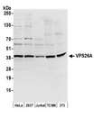 VPS26A / VPS26 Antibody - Detection of human and mouse VPS26A by western blot. Samples: Whole cell lysate (50 µg) from HeLa, HEK293T, Jurkat, mouse TCMK-1, and mouse NIH 3T3 cells prepared using NETN lysis buffer. Antibody: Affinity purified rabbit anti-VPS26A antibody used for WB at 0.4 µg/ml. Detection: Chemiluminescence with an exposure time of 10 seconds.