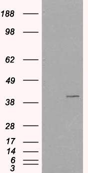 VPS26A / VPS26 Antibody - HEK293 overexpressing VPS26A (RC205353) and probed with (mock transfection in first lane).