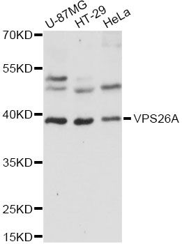VPS26A / VPS26 Antibody - Western blot analysis of extracts of various cell lines, using VPS26A antibody at 1:1000 dilution. The secondary antibody used was an HRP Goat Anti-Rabbit IgG (H+L) at 1:10000 dilution. Lysates were loaded 25ug per lane and 3% nonfat dry milk in TBST was used for blocking. An ECL Kit was used for detection and the exposure time was 5s.