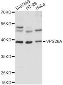 VPS26A / VPS26 Antibody - Western blot analysis of extracts of various cell lines, using VPS26A antibody at 1:1000 dilution. The secondary antibody used was an HRP Goat Anti-Rabbit IgG (H+L) at 1:10000 dilution. Lysates were loaded 25ug per lane and 3% nonfat dry milk in TBST was used for blocking. An ECL Kit was used for detection and the exposure time was 5s.