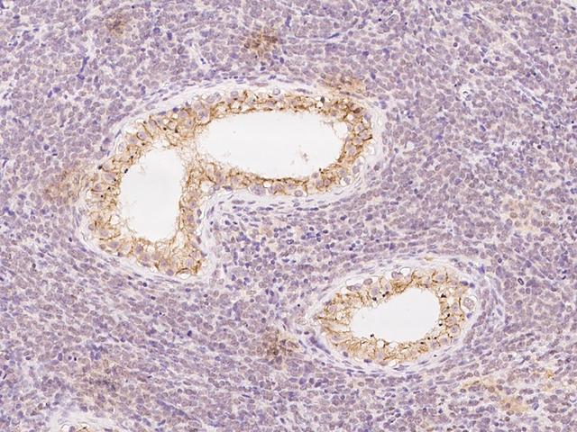 VPS26A / VPS26 Antibody - Immunochemical staining of human VPS26A in human testis with rabbit polyclonal antibody at 1:100 dilution, formalin-fixed paraffin embedded sections.