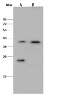 VPS26A / VPS26 Antibody - Anti-VPS26A rabbit polyclonal antibody at 1:500 dilution. Lane A: Jurkat Whole Cell Lysate. Lane B: HepG2 Whole Cell Lysate. Lysates/proteins at 30 ug per lane. Secondary: Goat Anti-Rabbit IgG (H+L)/HRP at 1/10000 dilution. Developed using the ECL technique. Performed under reducing conditions. Predicted band size: 40 kDa. Observed band size: 40 kDa.
