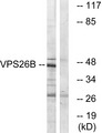 VPS26B Antibody - Western blot analysis of lysates from LOVO cells, using VPS26B Antibody. The lane on the right is blocked with the synthesized peptide.