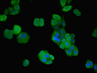 VPS26B Antibody - Immunofluorescent analysis of PC-3 cells using VPS26B Antibody at dilution of 1:100 and Alexa Fluor 488-congugated AffiniPure Goat Anti-Rabbit IgG(H+L)