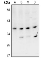 VPS26B Antibody - Western blot analysis of VPS26B expression in MCF7 (A), Hela (B), PC12 (C), AML12 (D) whole cell lysates.