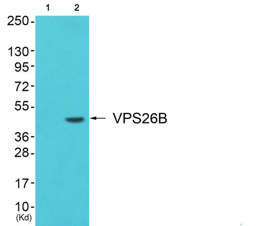 VPS26B Antibody - Western blot analysis of extracts from JK cells, using VPS26B antibody.