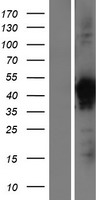 VPS26B Protein - Western validation with an anti-DDK antibody * L: Control HEK293 lysate R: Over-expression lysate