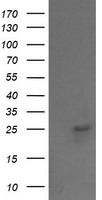 VPS28 Antibody - HEK293T cells were transfected with the pCMV6-ENTRY control (Left lane) or pCMV6-ENTRY VPS28 (Right lane) cDNA for 48 hrs and lysed. Equivalent amounts of cell lysates (5 ug per lane) were separated by SDS-PAGE and immunoblotted with anti-VPS28.