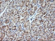 VPS28 Antibody - IHC of paraffin-embedded Human pancreas tissue using anti-VPS28 mouse monoclonal antibody. (Heat-induced epitope retrieval by 10mM citric buffer, pH6.0, 120°C for 3min).