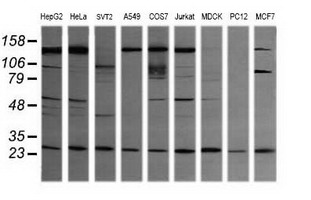 VPS28 Antibody - Western blot of extracts (35ug) from 9 different cell lines by using anti-VPS28 monoclonal antibody (HepG2: human; HeLa: human; SVT2: mouse; A549: human; COS7: monkey; Jurkat: human; MDCK: canine; PC12: rat; MCF7: human).