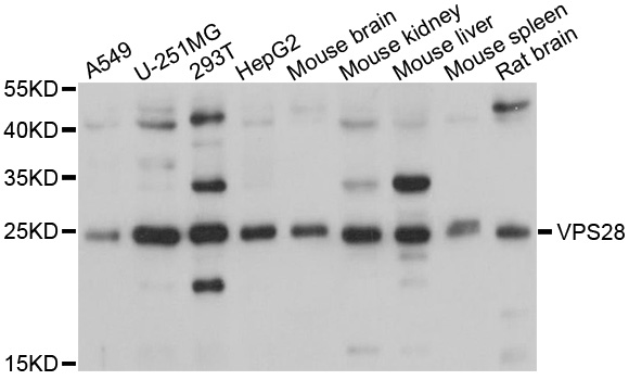 VPS28 Antibody - Western blot analysis of extracts of various cells.