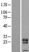 VPS28 Protein - Western validation with an anti-DDK antibody * L: Control HEK293 lysate R: Over-expression lysate