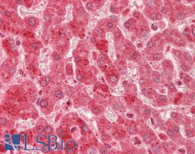 VPS29 Antibody - Human Liver: Formalin-Fixed, Paraffin-Embedded (FFPE).  This image was taken for the unconjugated form of this product. Other forms have not been tested.